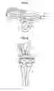 Fig. 05 - Attachment device