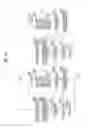 Fig. 15 - Heliostat calibration device and heliostat calibration method