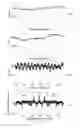 Fig. 15 - Coded localization systems, methods and apparatus