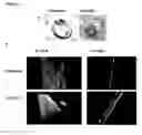 Fig. 03 - HIGH-RESOLUTION THREE-DIMENSIONAL IMAGING OF MAMMALIAN HEARTS