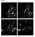 Fig. 04 - HIGH-RESOLUTION THREE-DIMENSIONAL IMAGING OF MAMMALIAN HEARTS