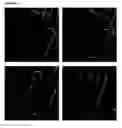 Fig. 06 - HIGH-RESOLUTION THREE-DIMENSIONAL IMAGING OF MAMMALIAN HEARTS