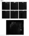 Fig. 08 - HIGH-RESOLUTION THREE-DIMENSIONAL IMAGING OF MAMMALIAN HEARTS