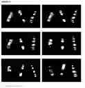 Fig. 10 - HIGH-RESOLUTION THREE-DIMENSIONAL IMAGING OF MAMMALIAN HEARTS
