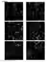 Fig. 14 - HIGH-RESOLUTION THREE-DIMENSIONAL IMAGING OF MAMMALIAN HEARTS
