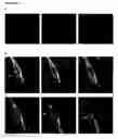 Fig. 15 - HIGH-RESOLUTION THREE-DIMENSIONAL IMAGING OF MAMMALIAN HEARTS