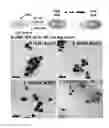Fig. 20 - Nanoparticles in the shape of nanosnowman with a head part and a body part, a preparation method thereof and a detection method using the same