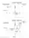 Fig. 10 - Method for classifying a defect in a component intended to have a monocrystalline structure