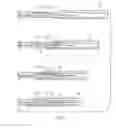 Fig. 04 - Progressive compression driven flow cartridge for analyte detecting strip and method