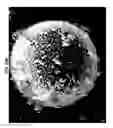 Fig. 113 - METHODS AND SYSTEMS OF USING EXOSOMES FOR DETERMINING PHENOTYPES