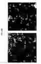 Fig. 114 - METHODS AND SYSTEMS OF USING EXOSOMES FOR DETERMINING PHENOTYPES