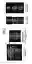 Fig. 02 - Magnetic resonance apparatus and method for simultaneous multi-contrast acquisition with simultaneous multislice imaging