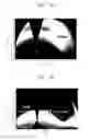 Fig. 07 - Optical device and methods for manufacturing the same
