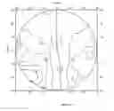 Fig. 43 - Method of modifying an dioptric function of an ophthalmic lens surface