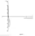 Fig. 74 - Method of modifying an dioptric function of an ophthalmic lens surface