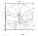 Fig. 94 - Method of modifying an dioptric function of an ophthalmic lens surface