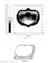 Fig. 05 - Direct-lit type backlight source and liquid crystal television