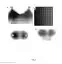 Fig. 02 - Gradient spray coating polymer pen arrays