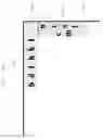 Fig. 49 - Apparatus for Selecting from a Touch Screen