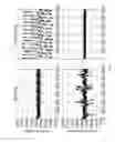 Fig. 16 - Methods and systems to sense situational awareness with a dual doppler and control for optimized operations