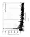 Fig. 18 - Methods and systems to sense situational awareness with a dual doppler and control for optimized operations