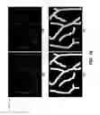 Fig. 11 - PALM VEIN-BASED LOW-COST MOBILE IDENTIFICATION SYSTEM FOR A WIDE AGE RANGE