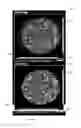 Fig. 06 - Multi energy X-ray microscope data acquisition and image reconstruction system and method