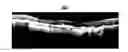 Fig. 01 - System and method for the segmentation of optical coherence tomography slices