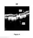 Fig. 05 - System and method for the segmentation of optical coherence tomography slices