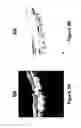 Fig. 06 - System and method for the segmentation of optical coherence tomography slices