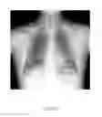 Fig. 15 - Method and system for image segmentation