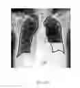 Fig. 24 - Method and system for image segmentation