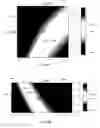 Fig. 06 - Segmentation and spectrum based metal artifact reduction method and system