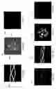 Fig. 07 - Segmentation and spectrum based metal artifact reduction method and system