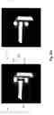 Fig. 10 - Segmentation and spectrum based metal artifact reduction method and system