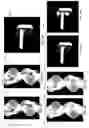 Fig. 11 - Segmentation and spectrum based metal artifact reduction method and system