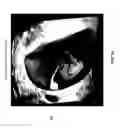 Fig. 05 - Utilizing depth from ultrasound volume rendering for 3D printing