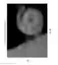 Fig. 07 - Utilizing depth from ultrasound volume rendering for 3D printing