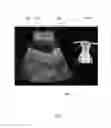 Fig. 06 - ULTRASOUND SIMULATION SYSTEM AND TOOL