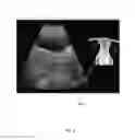 Fig. 07 - ULTRASOUND SIMULATION SYSTEM AND TOOL