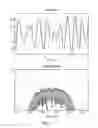 Fig. 12 - Calculator and method for determining phase correction data for an audio signal