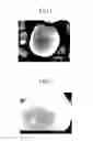 Fig. 02 - Olivine-type cathode active material precursor for lithium battery, olivine-type cathode active material for lithium battery, method for preparing the same and lithium battery with the same