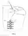 Fig. 02 - Handle For Structure For Attracting And Accumulating Aquatic Organisms