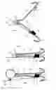 Fig. 02 - Torsion spring fish hook