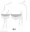 Fig. 04 - BREAST WEDGE SUPPORT APPARATUS AND METHOD