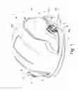 Fig. 02 - Helmet