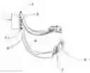 Fig. 01 - SINGLE APPLICATION IMPLEMENT AND METHOD TO GENERATE MULTIPLE HAIR CURLS