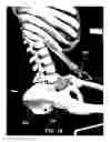 Fig. 19 - Adjustable chair support system
