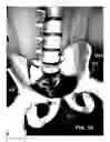 Fig. 20 - Adjustable chair support system