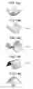 Fig. 13 - Image processing apparatus, image processing method, and computer-readable recording medium for determining abnormal region based on extension information indicating state of blood vessel region extending in neighborhood of candidate region